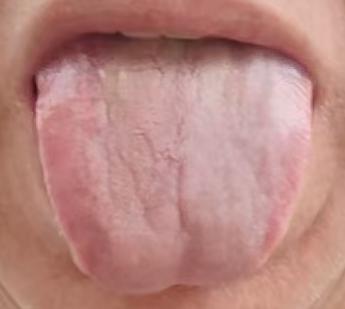 瘀血阻滞下焦经脉，散结通经破除拘紧，恢复房事正常勃发





很多人房事之所以