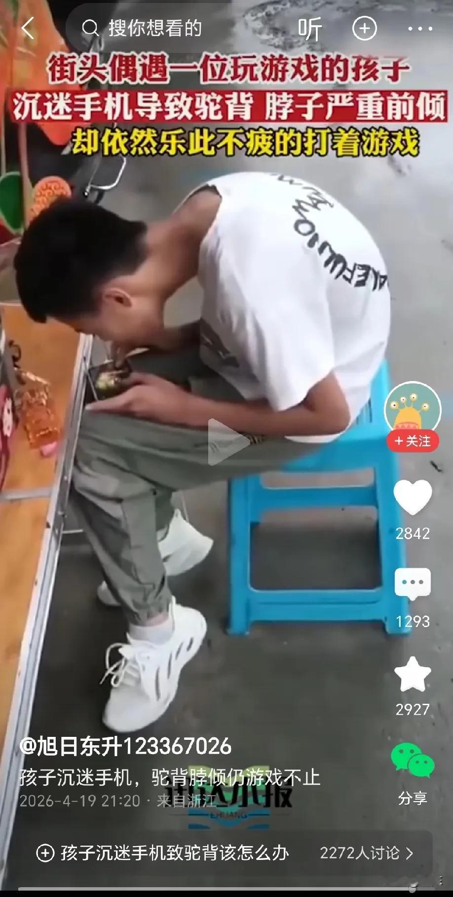 太可怕了！视频中的男孩由于长期沉迷手机游戏，导致驼背，脖子严重前倾，眼睛就差贴在