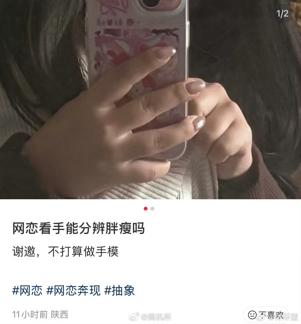 手胖的人解释不清了原来手被冻伤后会变粗啊