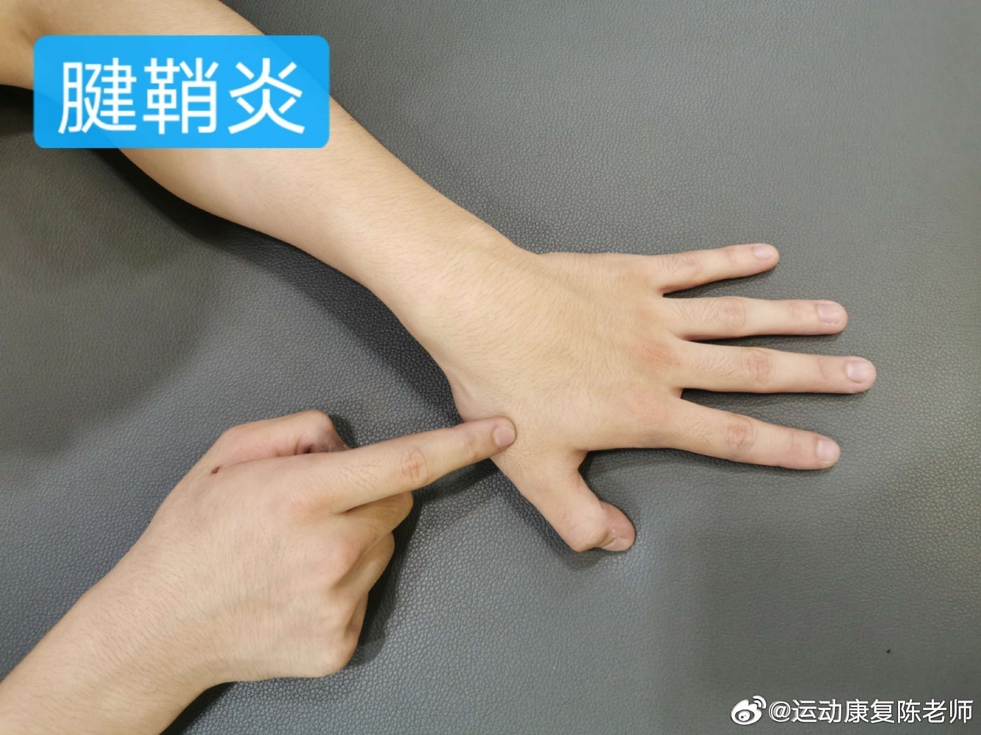 手腕 好久没讲手腕了，来聊聊常见手腕疼痛与损伤，尤其是一用力就疼，转手腕会响的朋