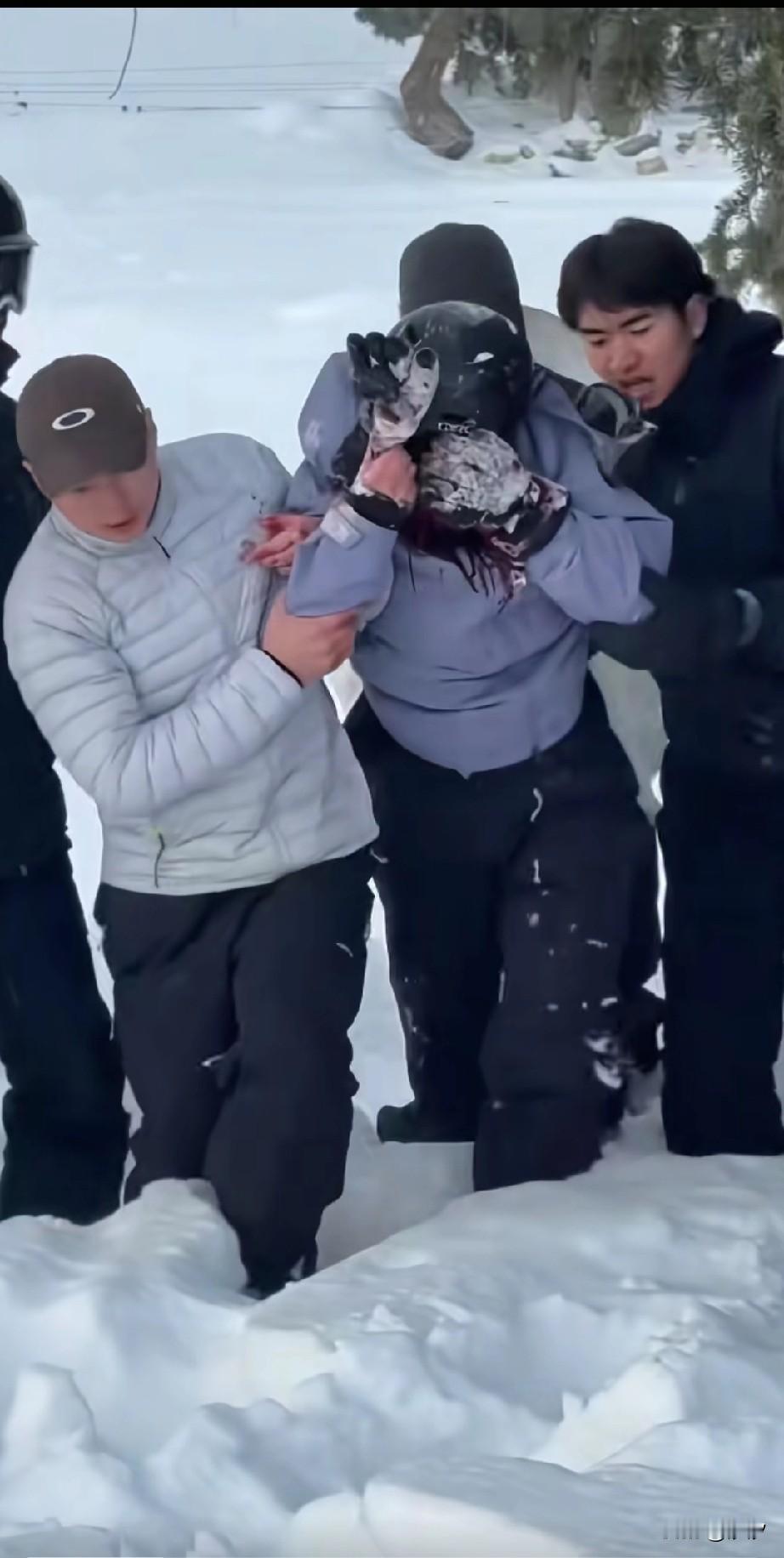 新疆可可西里雪豹伤人事件引发网络讨论，看完所有事件后，才发现最受伤的就是雪豹！