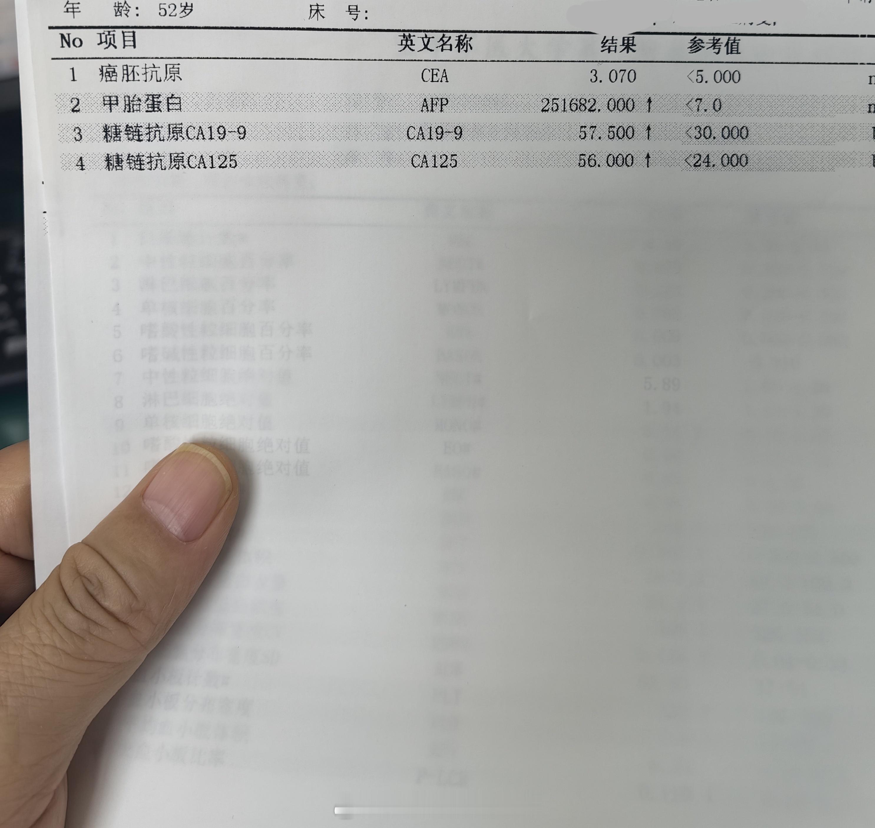 #为什么很多肝癌一发现就是晚期#又一例！多年的乙肝一直不体检，一直不治疗。出现腹