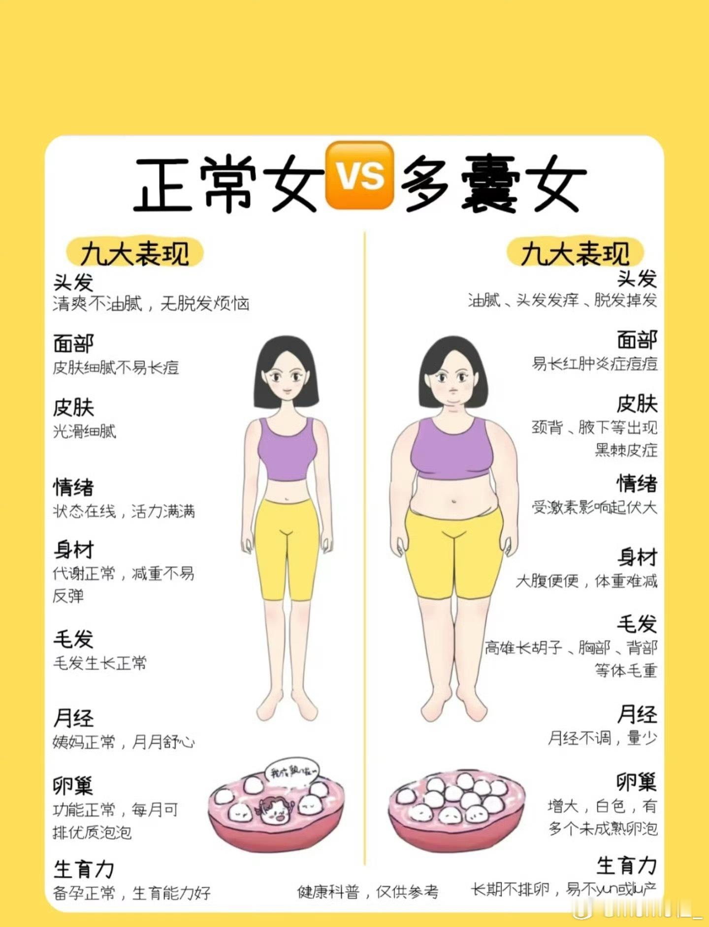 你以为的多囊vs实际上的多囊 多囊会变胖变丑！吃的药也会让人变胖[捂嘴哭] ​​