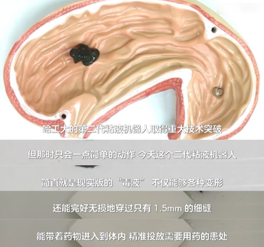 科学家研发能治病的毒液机器人   电影里的“毒液”想搞事情，到了我们哈工大和郑州