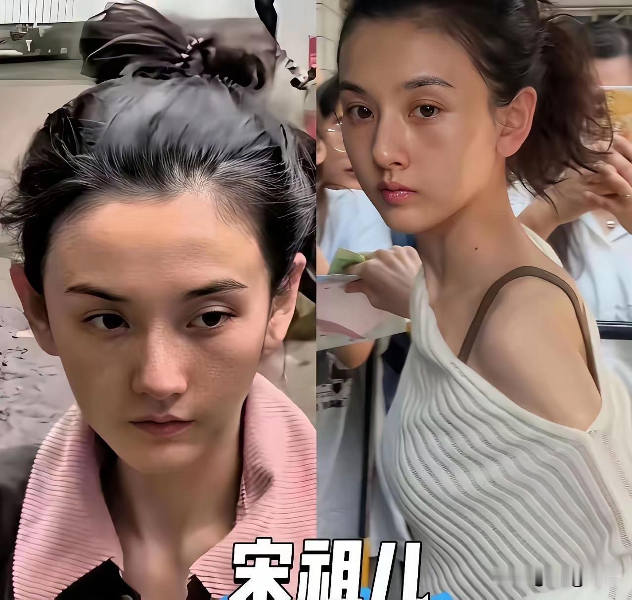 女明星为了上镜好看，减肥是常态。但瘦成这个样子，真的有点过了。锁骨能养鱼，手臂细