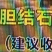 胆结石这玩意儿，真的让人头疼。不过，还真有它的克星！每天坚持多喝水，效果那叫一个