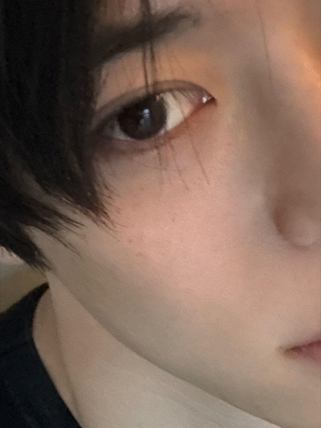 小雀斑 长睫毛 兔子嘴 