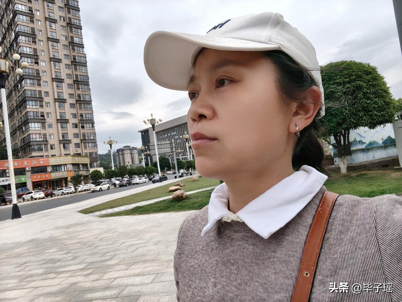 我85年，属牛的，是一个宫颈癌患早中期患者，38岁切除了子宫和卵巢，无法独立生活