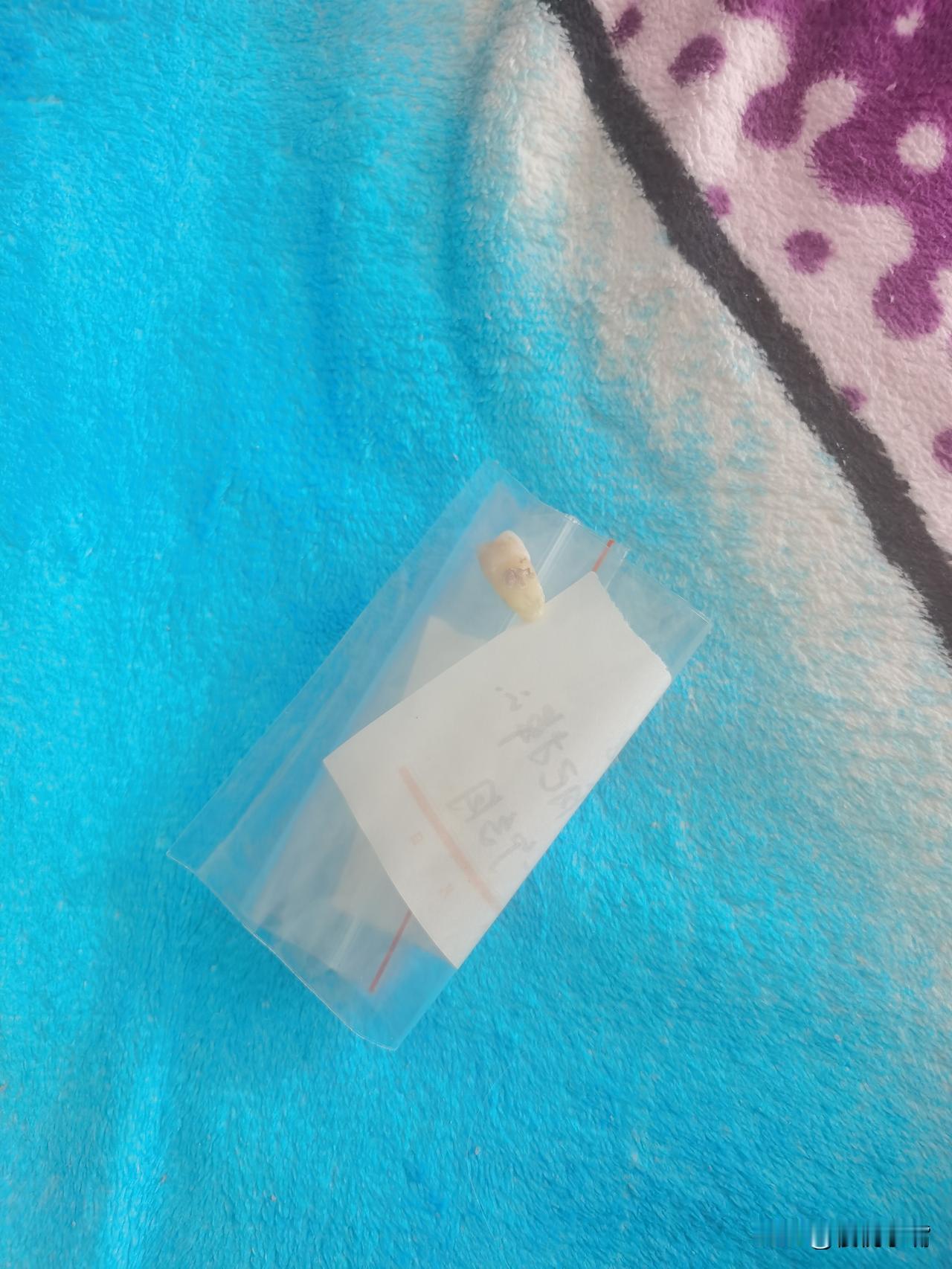 吃瓜子把牙磕松动了，
后来竟发炎了。
牙床肿起个大包，
疼得连嘴都不敢张，
整整
