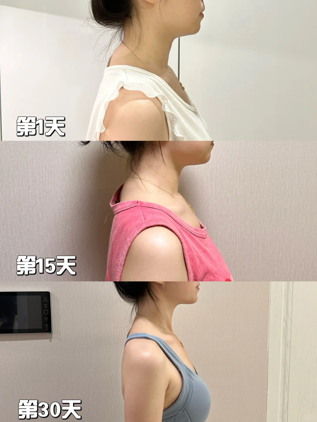 悟了❗睡前躺床上就能改善体态！告别颈椎病