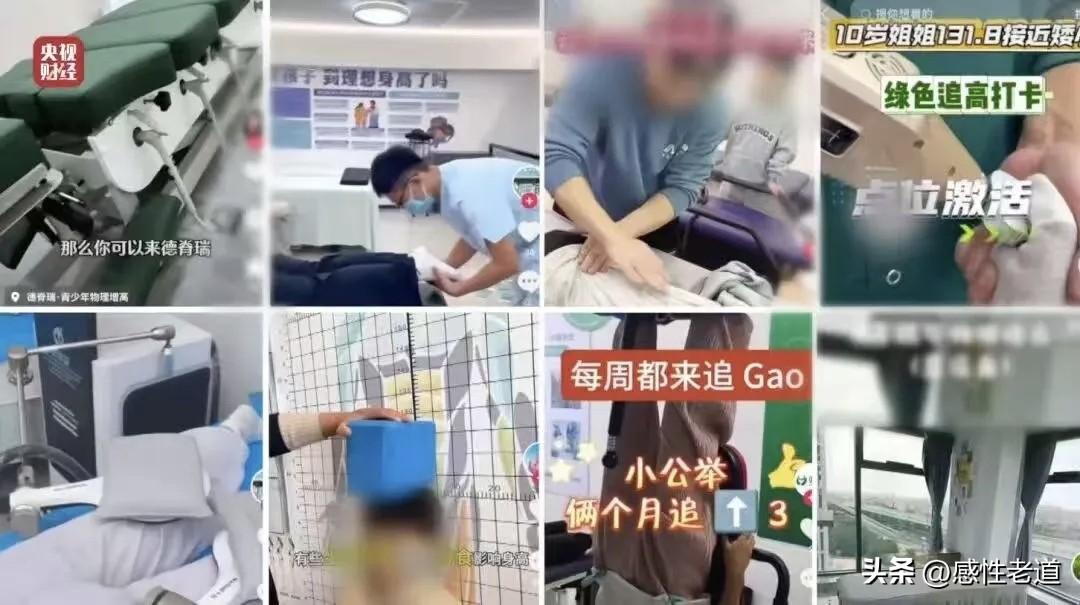 全世界的骨科医所有正规医学渠道只会告诉你：成年后想要改变身高，唯一极端的方式是断