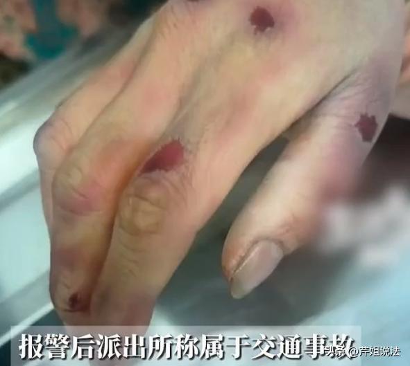 河北邯郸，李芳骑电动车上班，在乡镇路口被未拴绳大型犬撞倒头着地身亡，狗主人在旁未