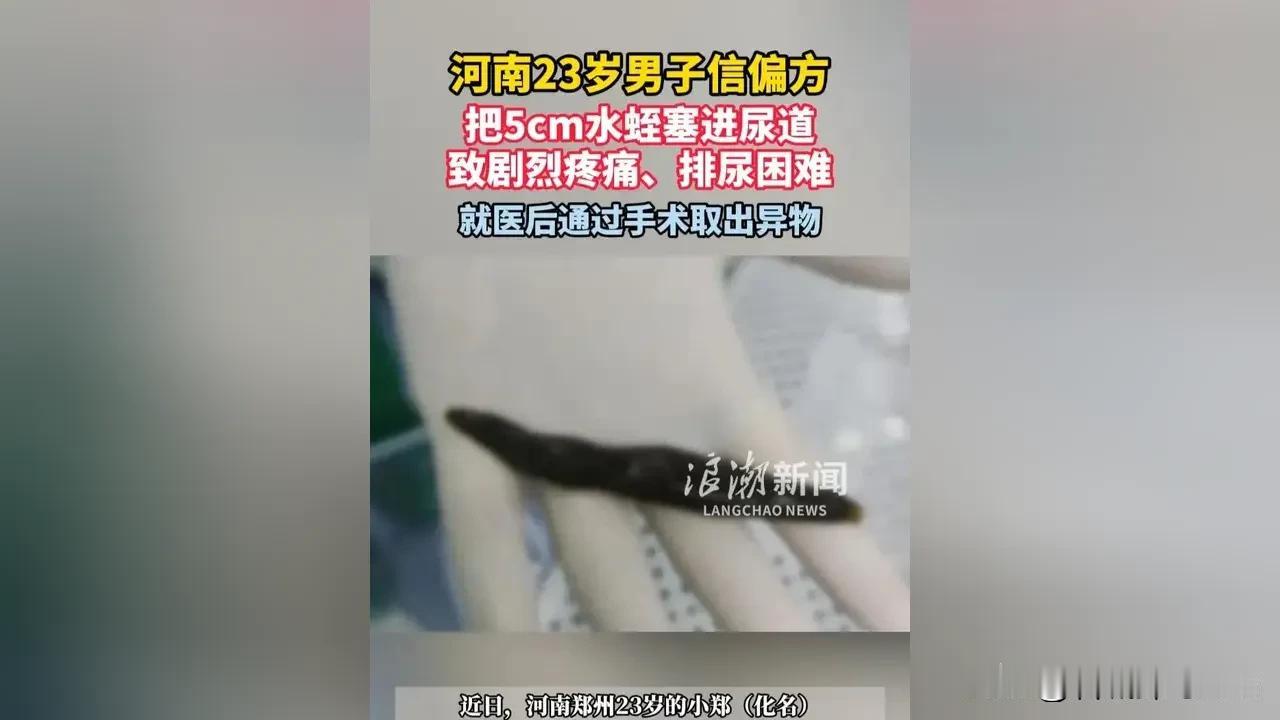 “是个狠人！”
河南，一23岁小伙子因为好奇，把一只活体水蛭塞进了自己的尿道，谁