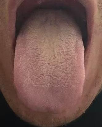 固摄不足莫烦恼，温阳固精调理有方







有不少精气耗伤过度的朋友问我，对