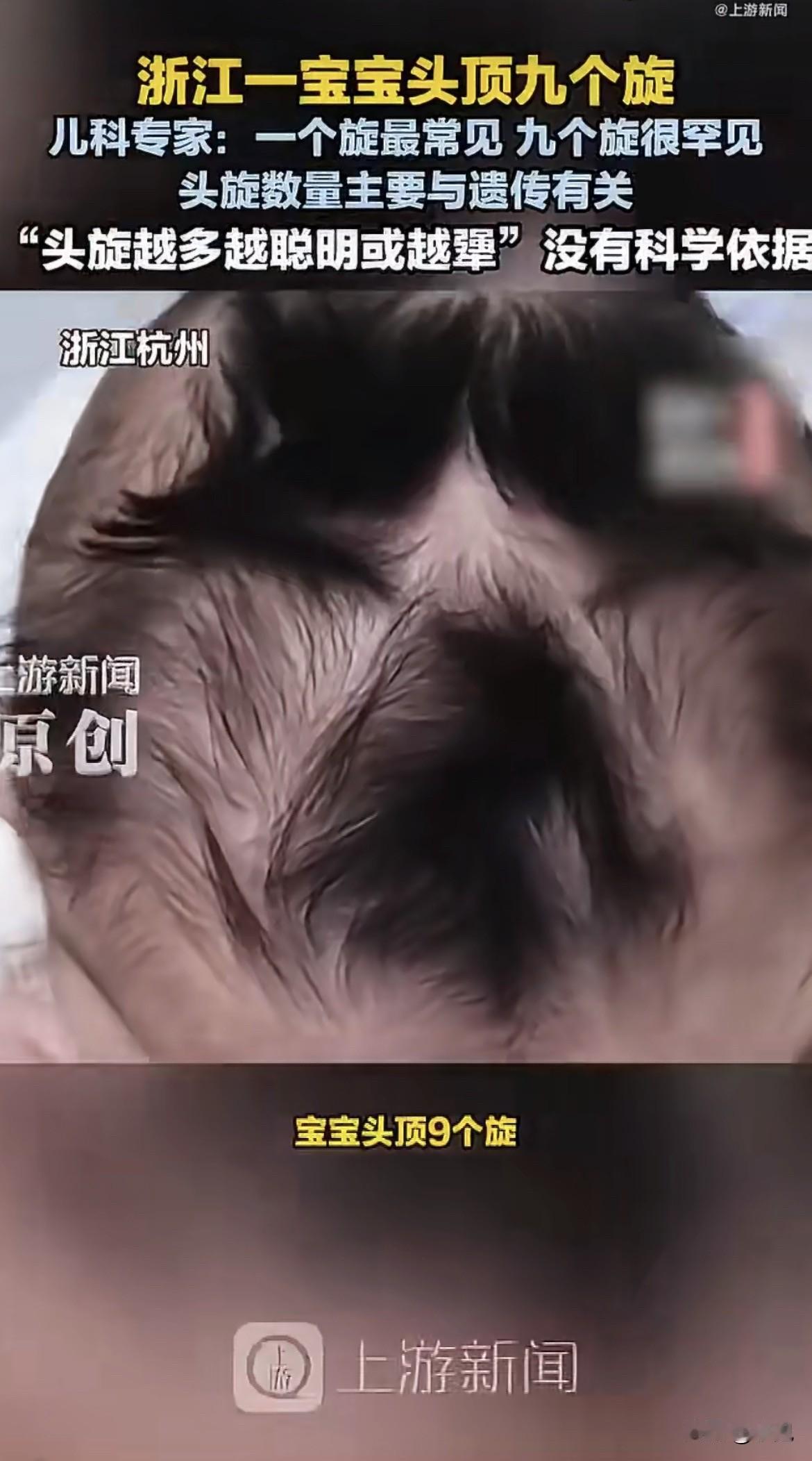 浙江一个刚出生的宝宝，头顶长了九个发旋。

九个。

照片传到网上，评论区直接炸