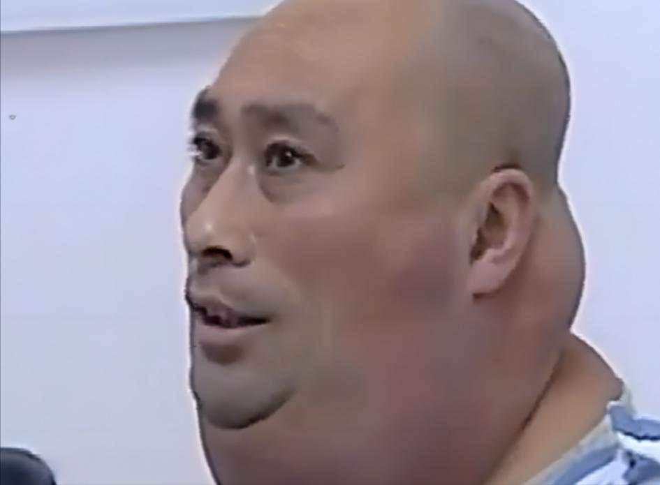 这也太吓人了，医生都说治不了，2013年末，东北李秋武把自己裹得严严实实的，来到