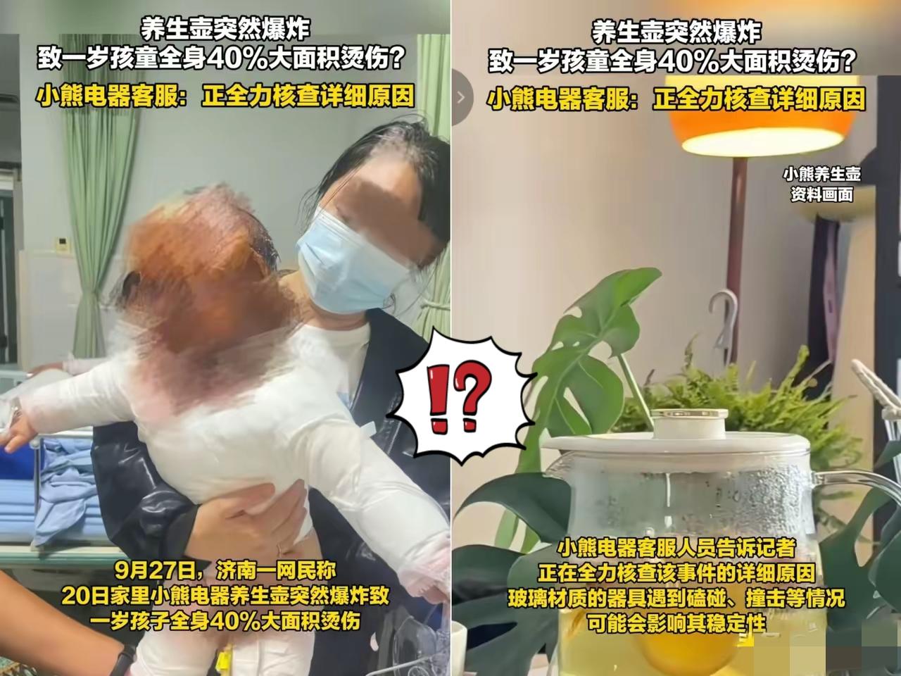 太心疼了！

 济南一宝妈爆料，自家小熊养生壶突然爆炸，一岁孩子全身40%被烫伤