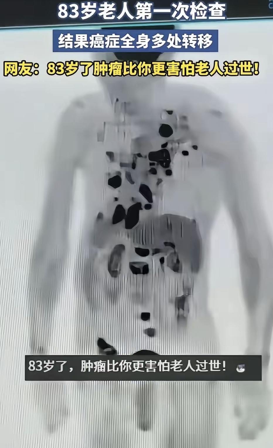 昨天去探望隔壁王爷爷，他正坐在院里剥毛豆，手稳眼亮，说话中气十足。他今年83，上