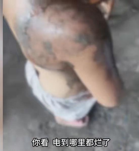 万万没有想到，一个打火机的电击后威力这么大？

2025年9月15日，广西钦州发