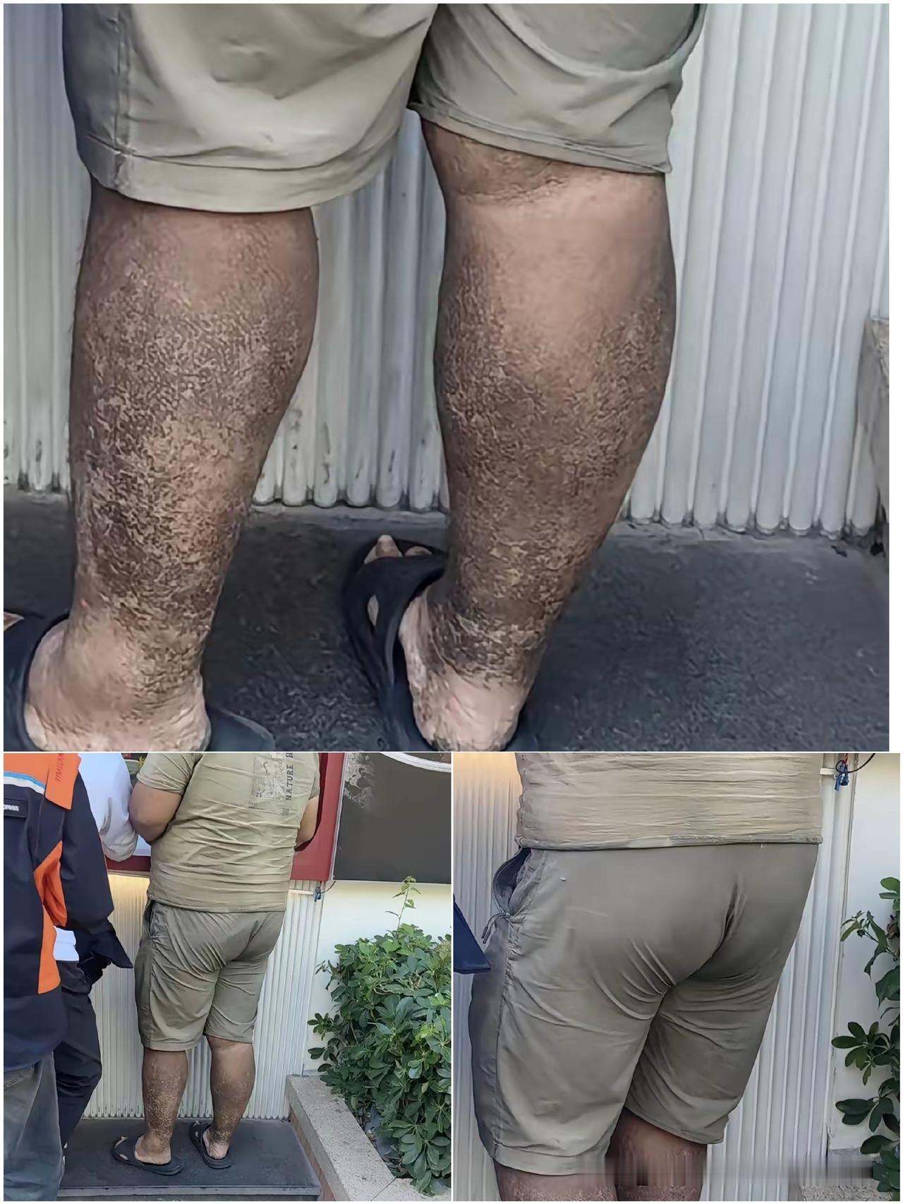 他送的外卖你敢接吗？
 
刷到个外卖员背影我直接愣住！腿上黑垢堆得像“天然盔甲”