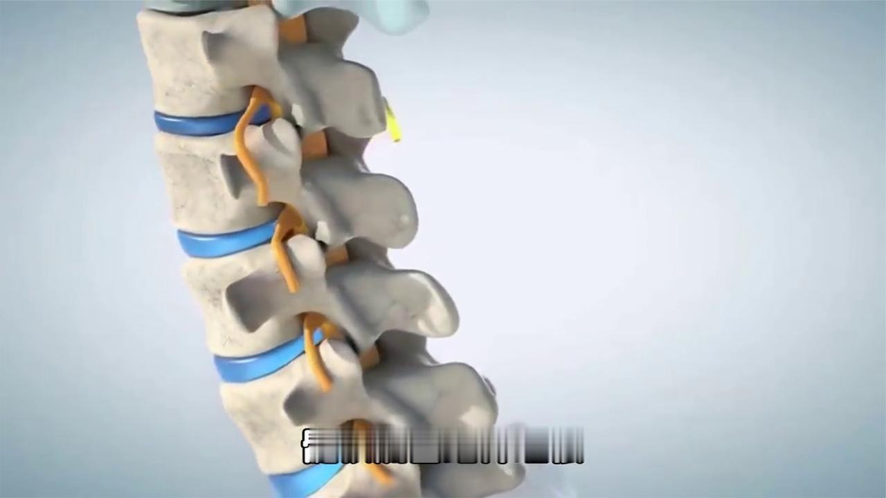 骨科医生建议：只要发生过腰椎间盘突出，日常保养务必落实这几点