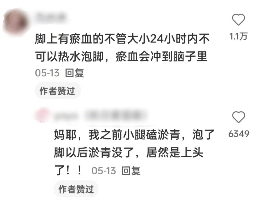 啊？？？？？脚上有瘀血的时候不能泡脚吗[晕]冲进脑子里是不是会变成血栓。。。 ​