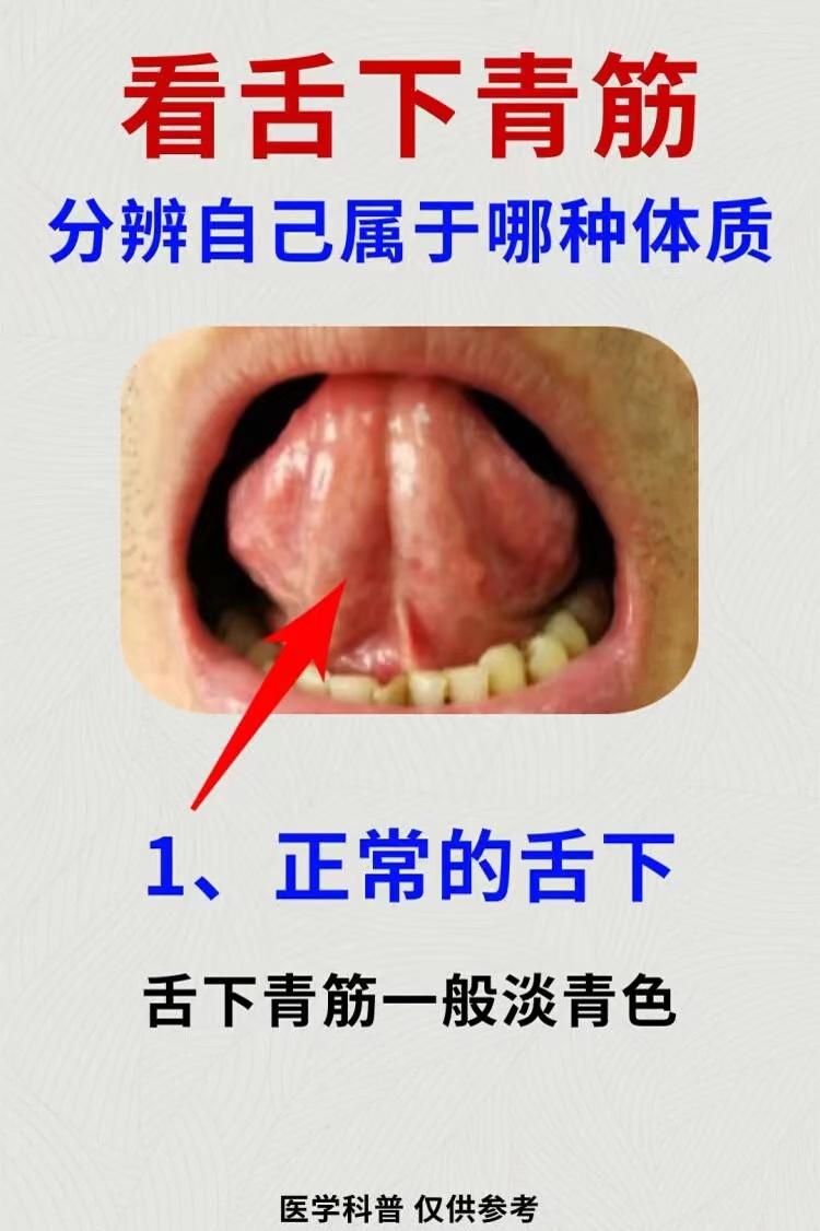 血瘀生百病，潘医生教你1个方法，自测血瘀！
方法其实很简单，大家伸出舌头
看看舌