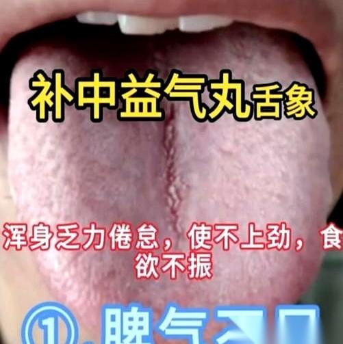 哎哟喂，姐妹们，哥们儿！你们有没有那种感觉，就是吃啥都不香，身体软趴趴，动不动就