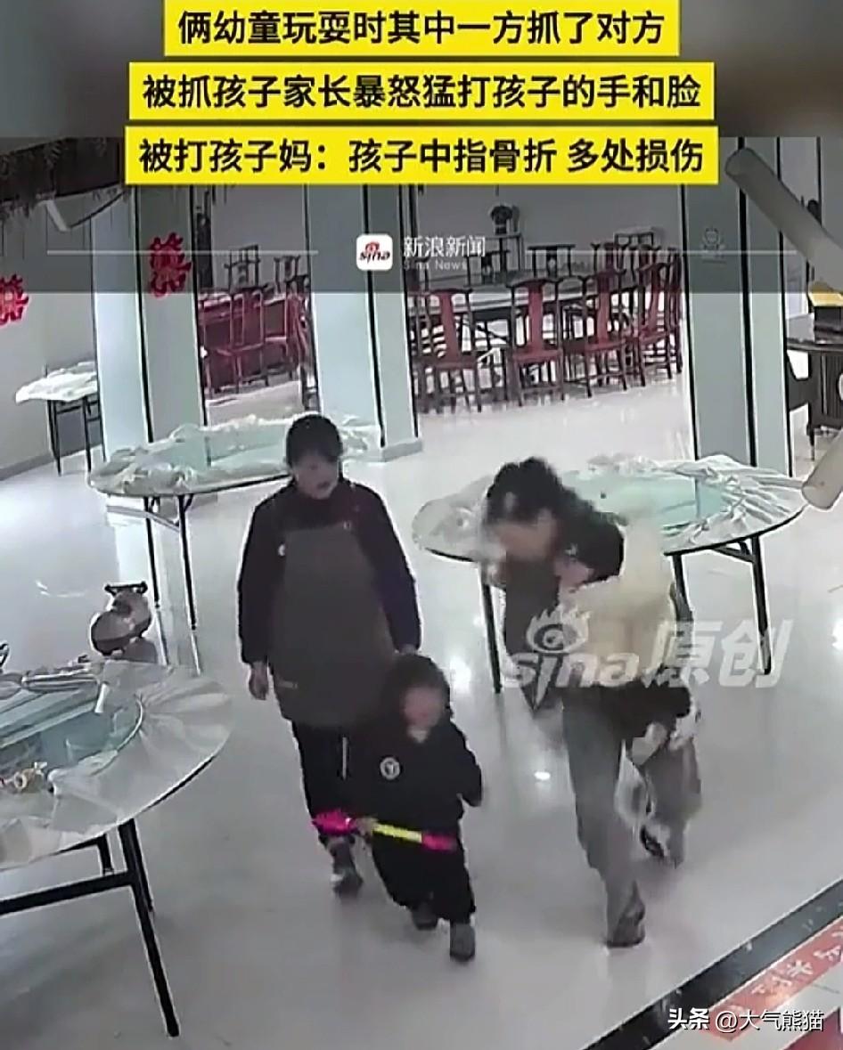 这事不好收场了！
一位妈妈因为自己的孩子被打，竟然出手把另一个孩子手指给打骨折了