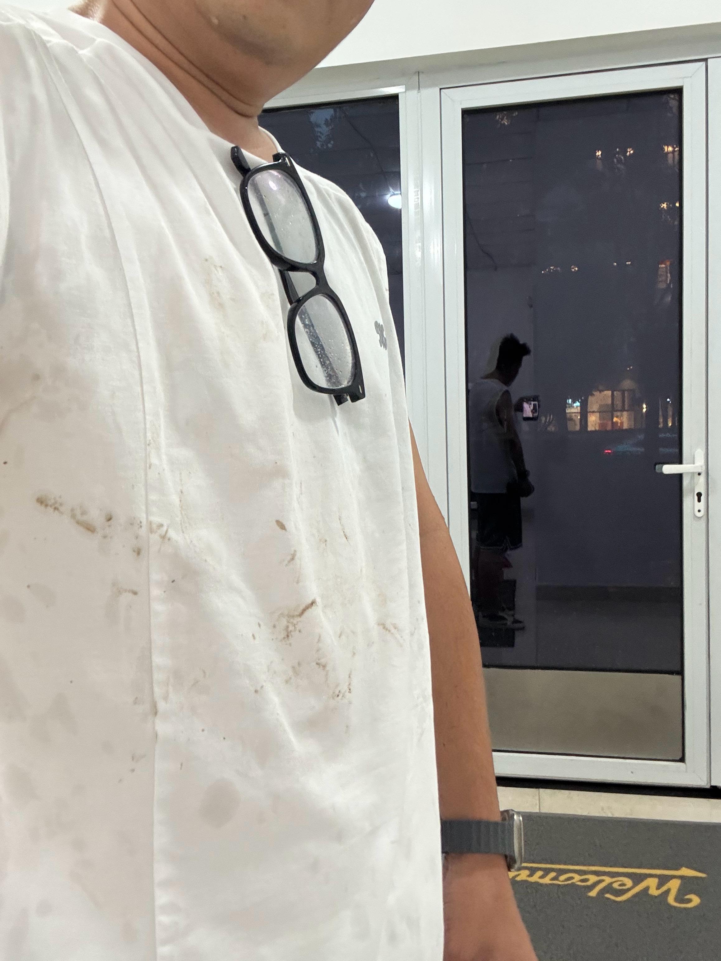 出来接孩子，下雨走快了几步。我还是低估了练腿的后果。摔了个大马趴，爬了好几分钟才