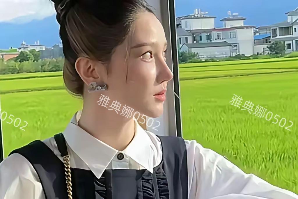 陈小纭是美颜开大了，还是又动脸了？
感觉她又跟以前长得不一样了，脸和鼻子都特别尖