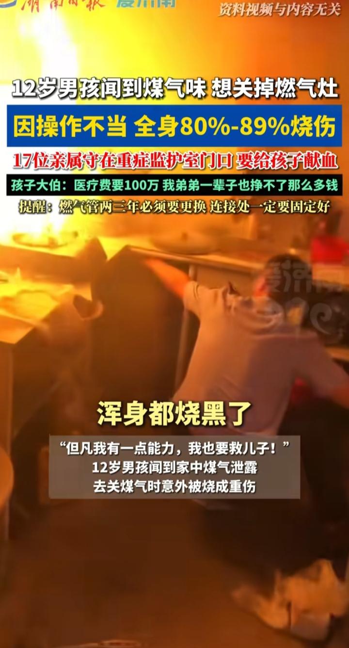 12岁男孩闻煤气味关阀门被烧伤：懂事的代价，是每个家庭都该警惕的安全盲区
 
河