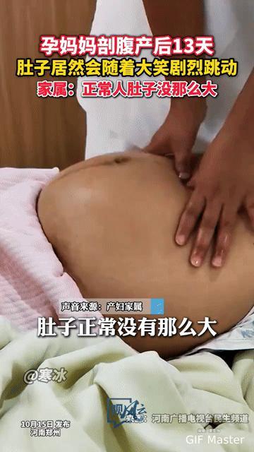 剖腹产后13天肚子随大笑剧烈跳动，新手妈妈看了都揪心！这正常吗？
 
你能想象吗