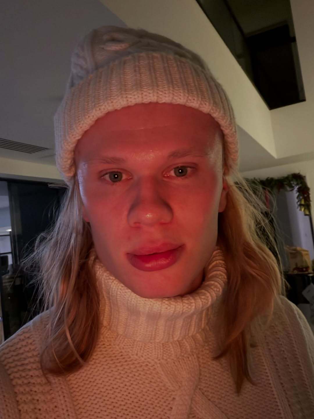 【阿斯报】哈兰德在训练中受伤，因此缺席对阵利兹联的比赛，距对阵皇马仅剩 11 天