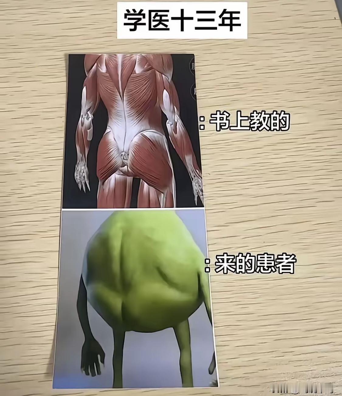 哈哈哈，太真实了[笑哭]
