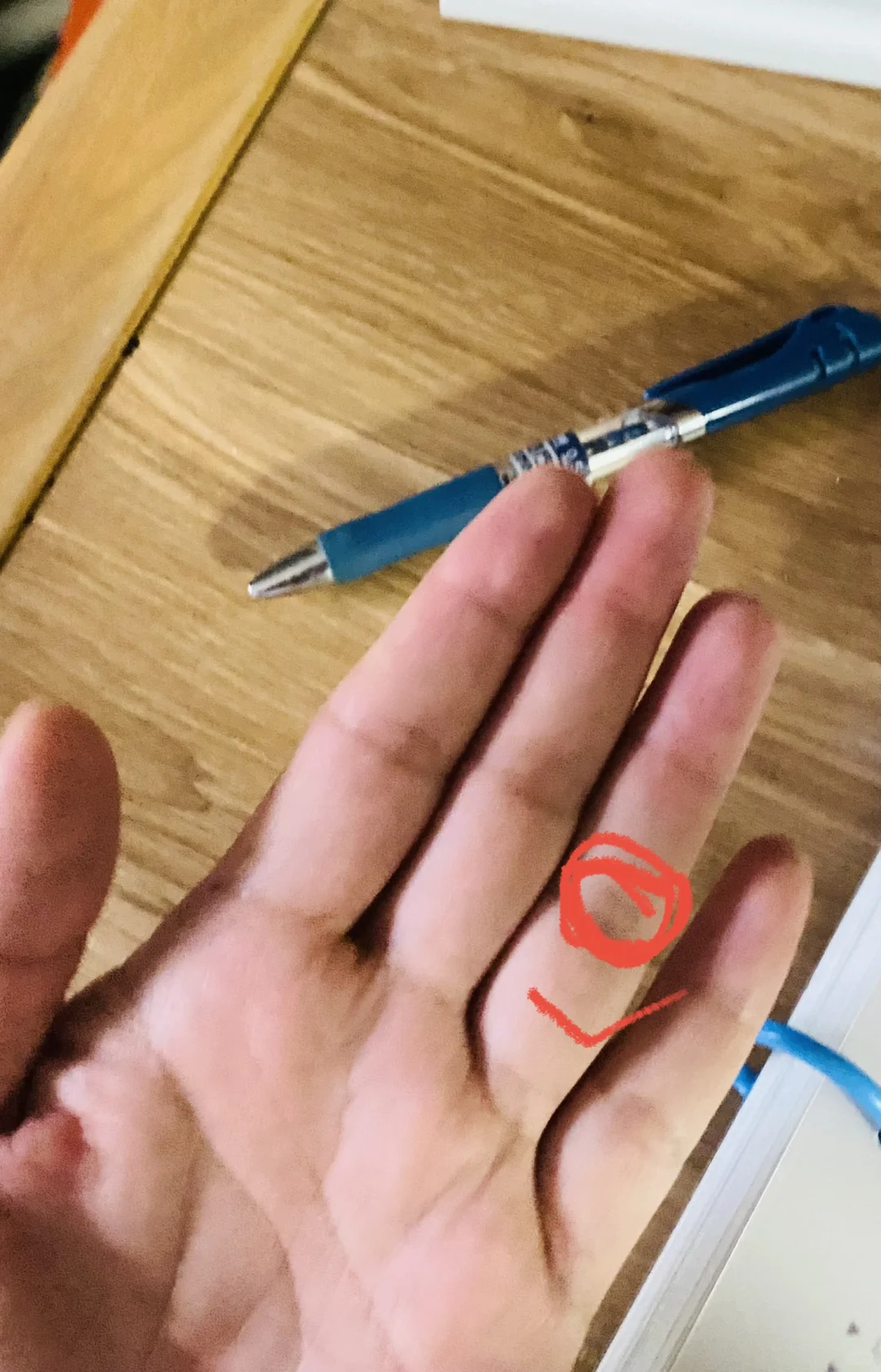 今日分享：小手法大养生干货系列之——-脱发！