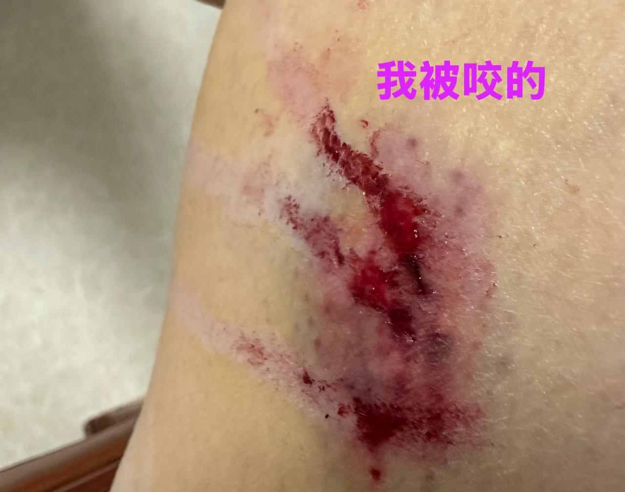 都是深圳人，素质咋这么不一样尼？同样是因遛狗不牵绳惹出的祸端，结果大相径庭。
