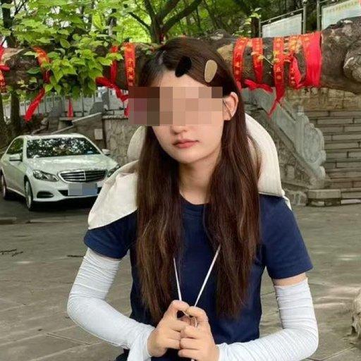 19岁大学生熬夜直播突发脑出血致瘫事件
 
山东有个19岁的女大学生叫王蕊，原本