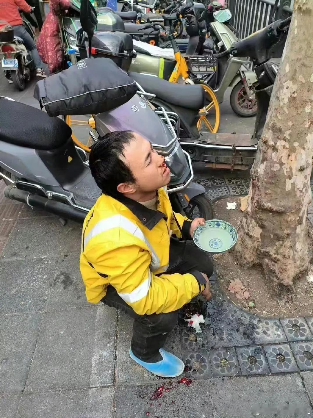 为还债送外卖3年挣了102万的外卖小哥被打了！据说这个外卖小哥被同行打了，同行们