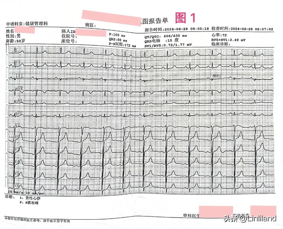 加速性室性自主心律、干扰性房室脱节、室性融合波心电图1例。

患者男性，51岁，