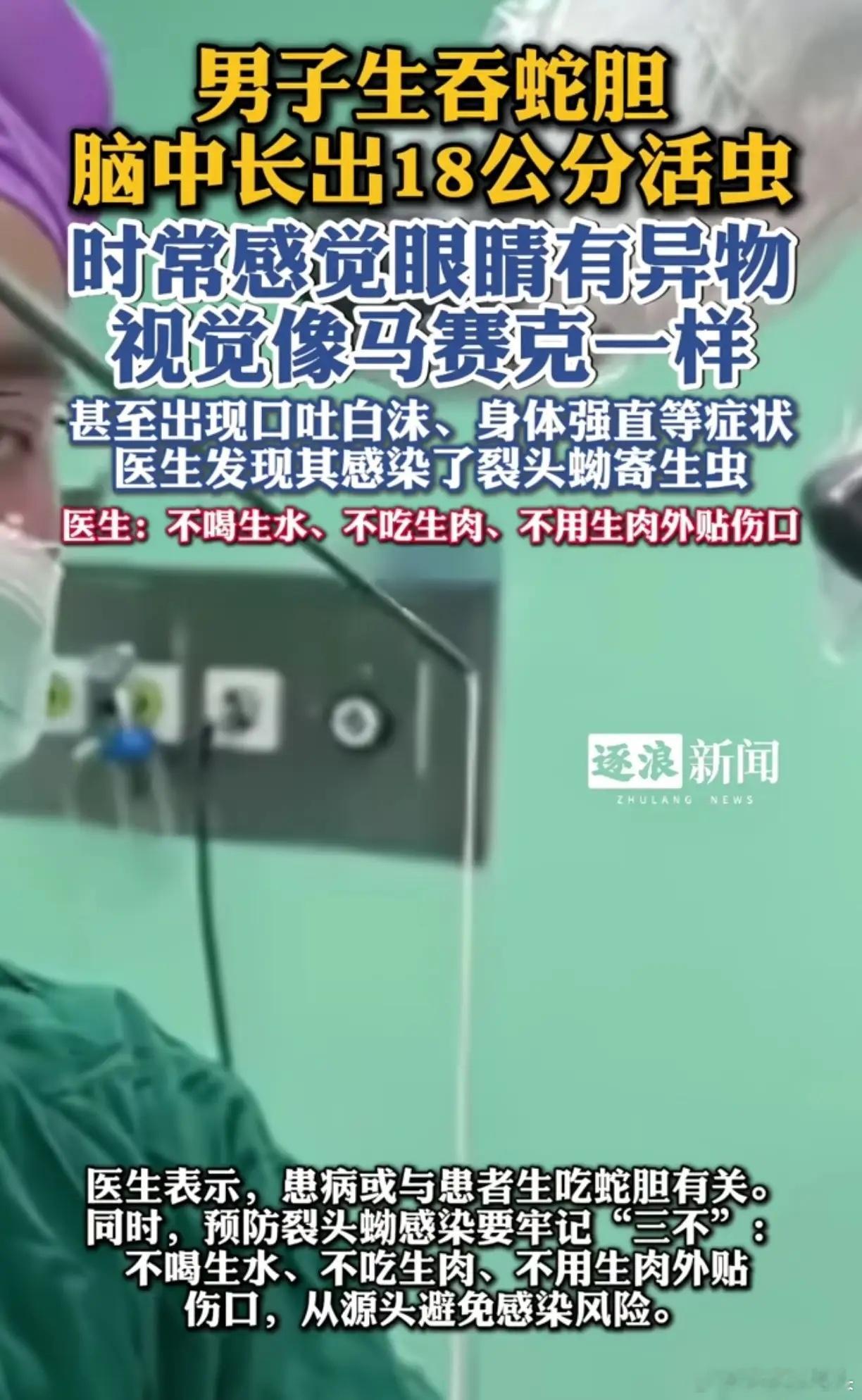 男子生吞3-4个蛇胆后脑中长18公分活虫，出现口吐白沫等症状 8月29日，广东广