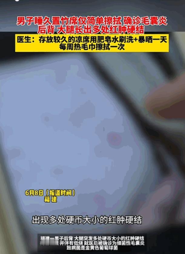 太吓人了！6月8日报道，福州有个老兄热得受不了，翻出了在柜子顶躺了一整年的陈年竹