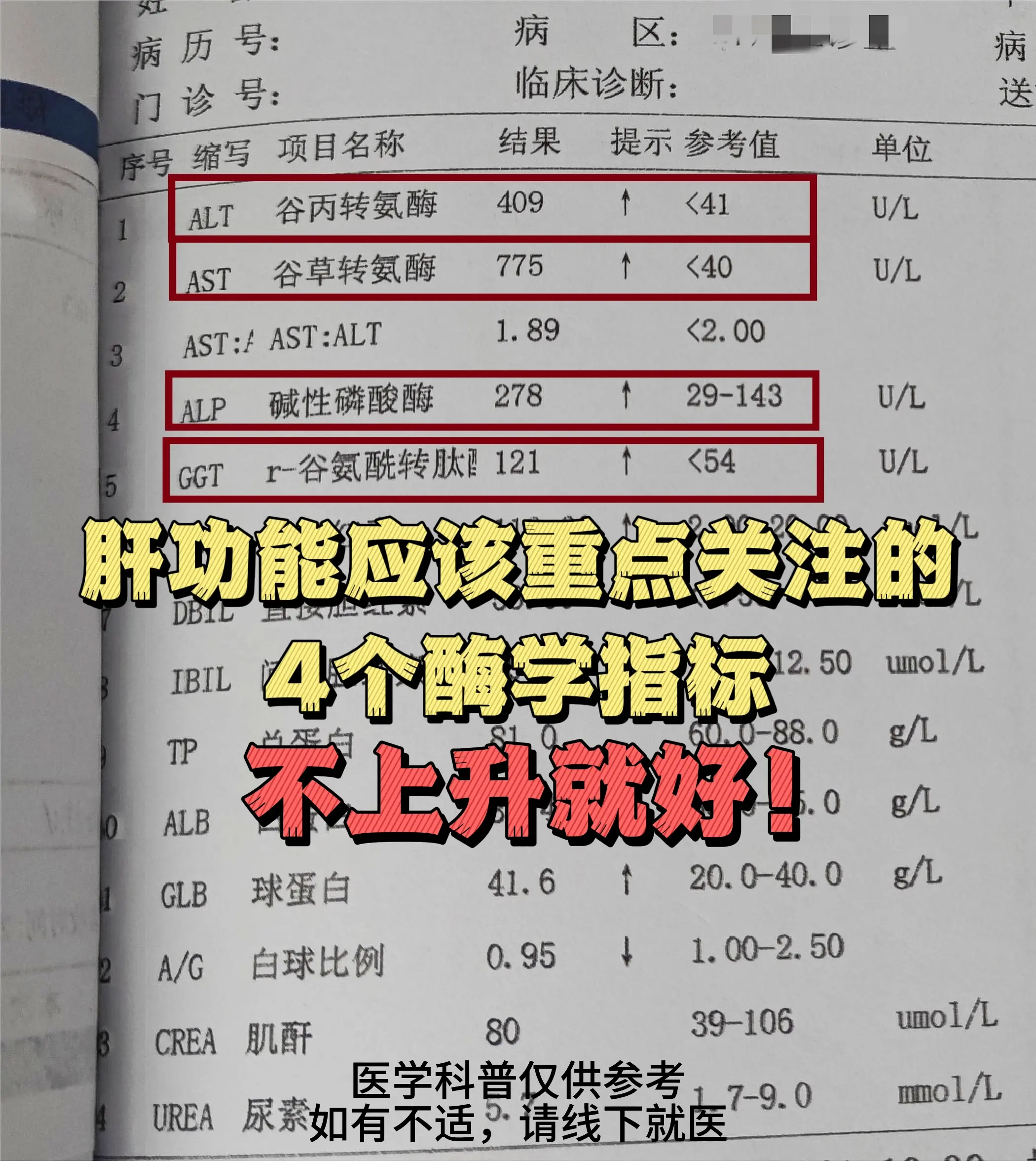 肝功能盯好这4个酶，异常升高小心有肝病！ 1. 谷丙转氨酶存在于肝细胞...