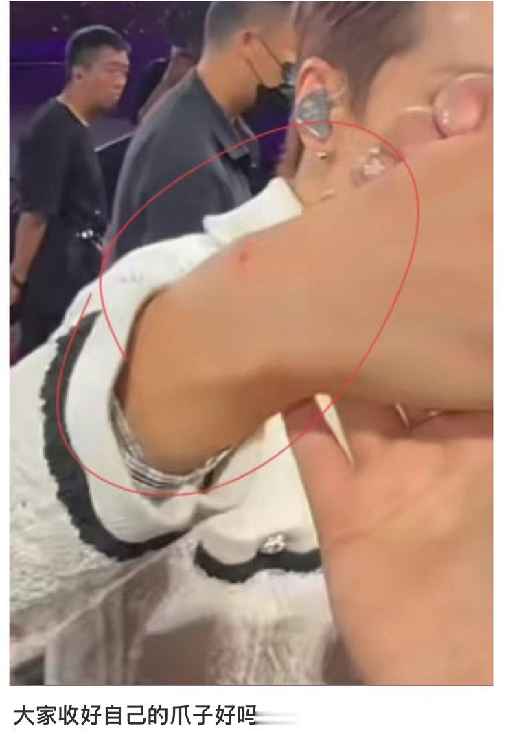 汪苏泷被粉丝抓伤汪苏泷握手环节被抓伤 汪苏泷握手环节被抓伤 ​​​