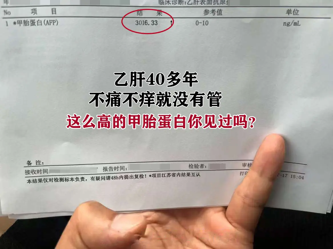 这位兄弟乙肝小三阳病史40余年，就因为觉得这个病不痛也不痒的，从不检查...