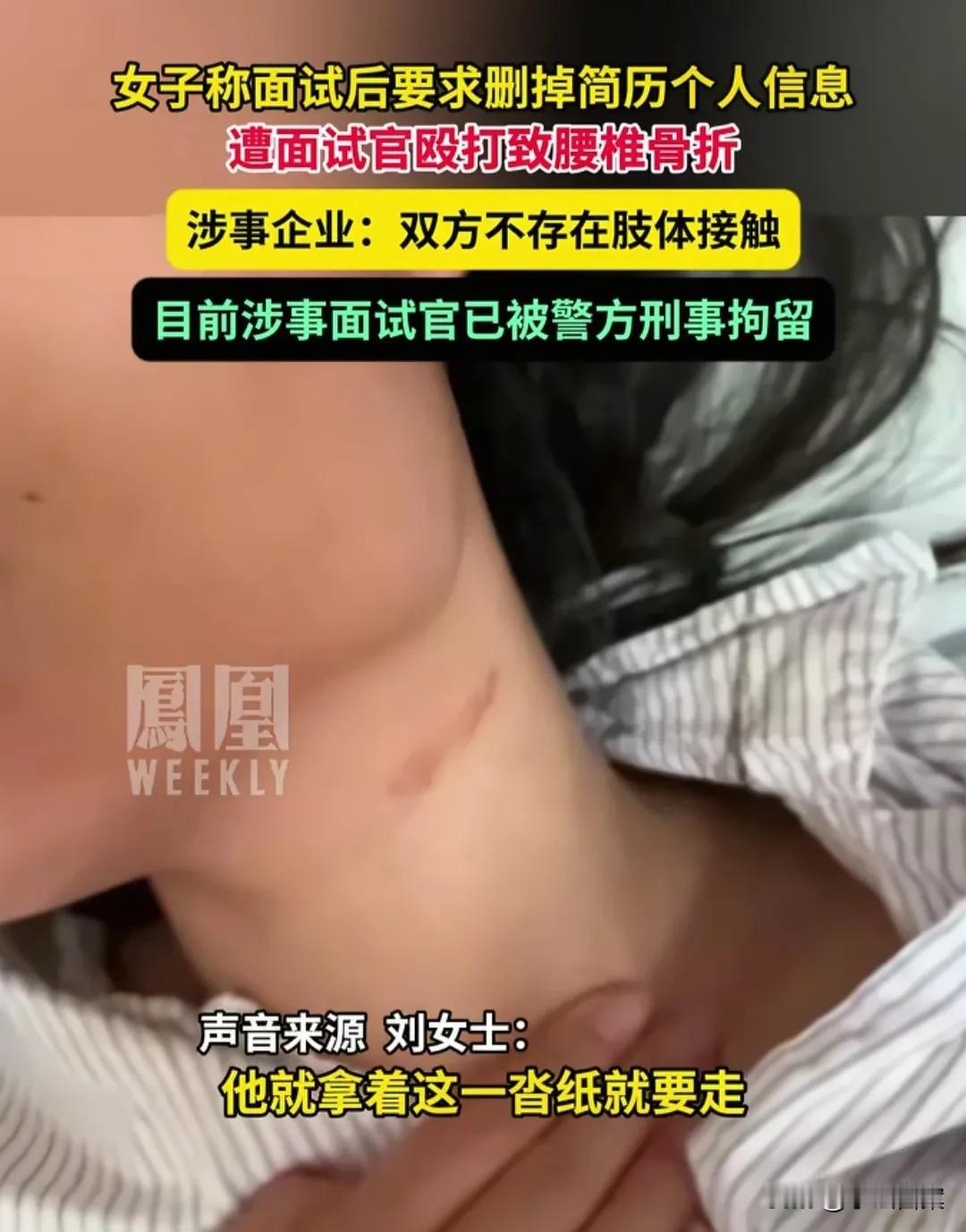 大快人心！深圳面试打人事件，女子坚决不和解，她伤情鉴定为轻伤二级，男老板已被刑拘