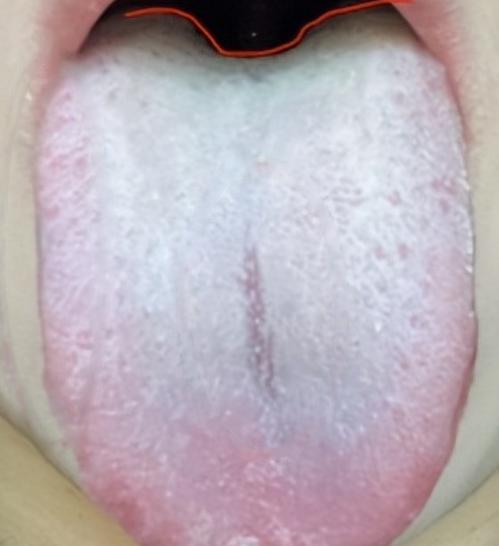 引火归元是补肾最好的方法，没有之一！
 
其实当咱们阳虚到一定程度的时候，很容易