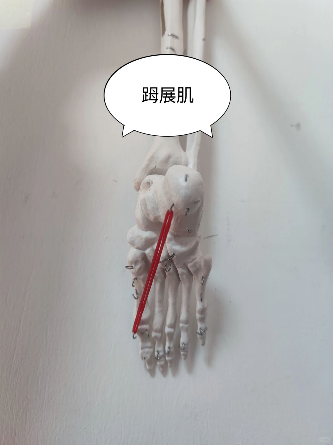𧿹展肌