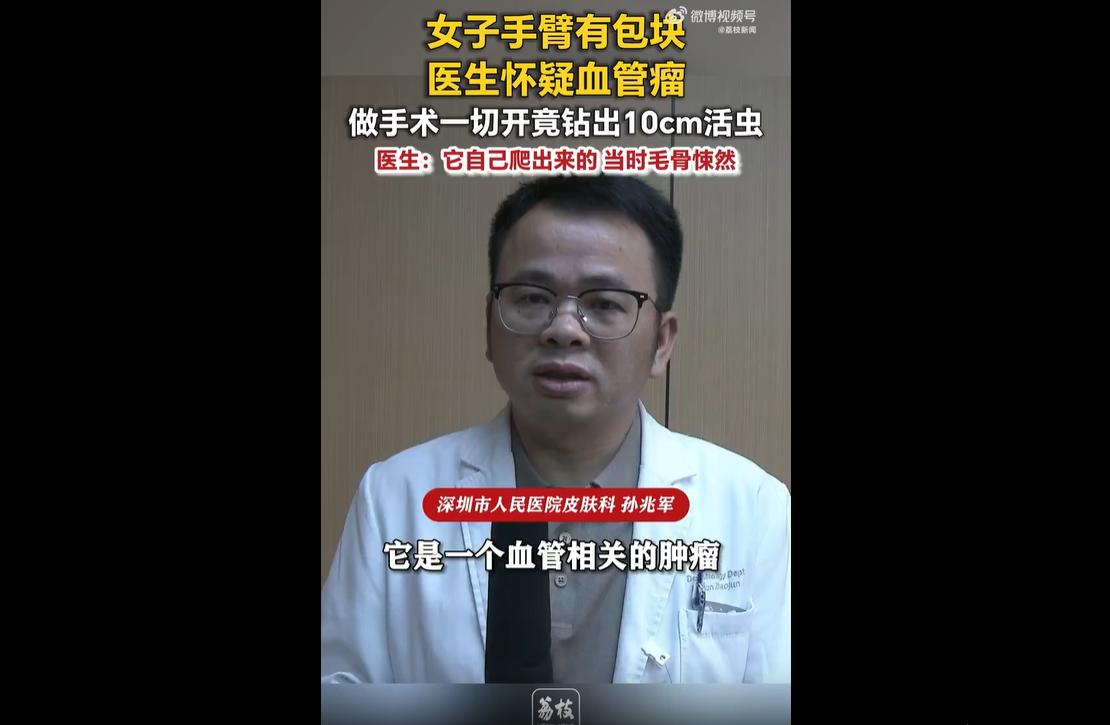 广东王女士左上臂一年前长出花生大小的疼痛包块，后续逐渐增大、皮肤变色、痛感加剧。