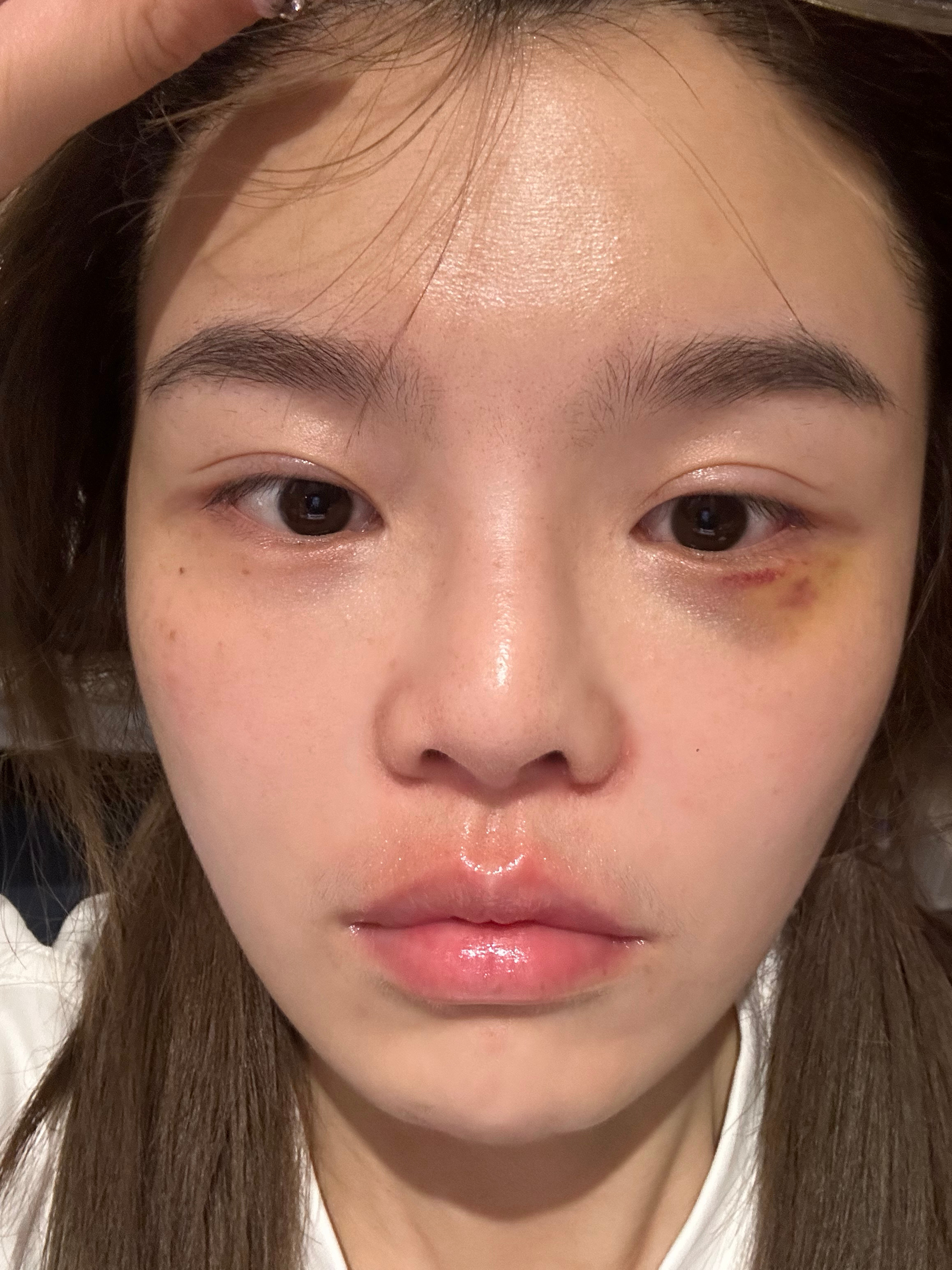 在自己家走路摔了一跤摔出了被家暴的感觉 ​​​